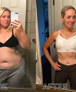 UNPREE™ BeeVenom Lymphatic Drainage Slimming Patch