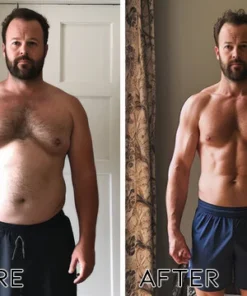 UNPREE™ BeeVenom Lymphatic Drainage Slimming Patch