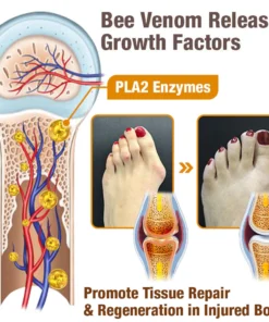 flysmus™ HalluxCare Bee Venom Treatment Cream