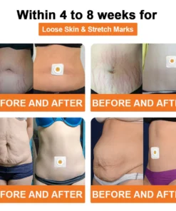 Lenreey® Bee Venom Lymphatic Drainage Slimming Patch