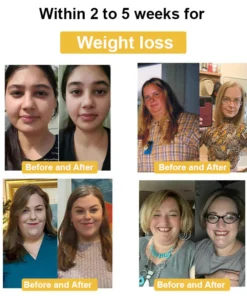 Cvreoz™ Včelí Jed Výstřihování Léčba Postižení