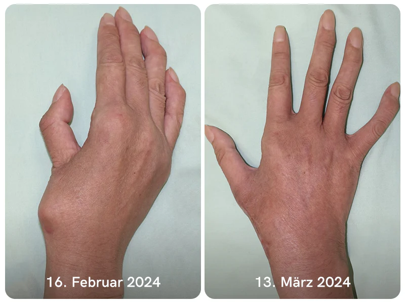 Furzero™ Bienengift Bone & Joint Professional Care Gel