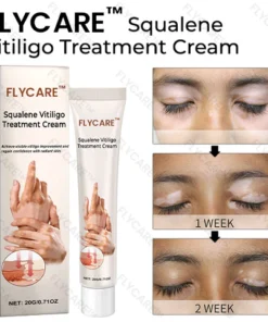 FLYCARE™ Squalene Vitiligo Treatment Cream