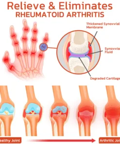 DeerAntler Joint and Bone Therapy Balm
