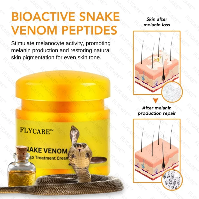 FLYCARE™ Snake Venom Vitiligo Treatment Cream