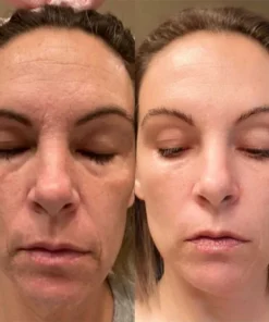 Ceoerty™ Ginseng Lifting and Firming Roller Essence