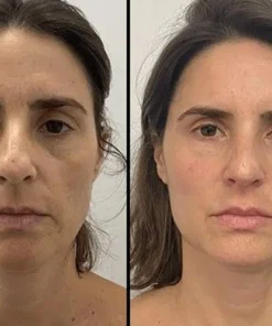 Ceoerty™ Ginseng Lifting and Firming Roller Essence