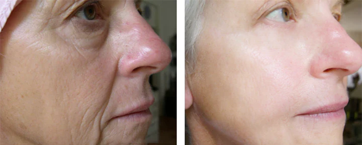 Ceoerty™ Korean Peptide Deer Bone Soluble Collagen Film