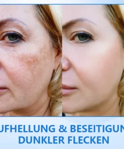 Ceoerty™ LuxeLift B5 Hautstraffende Jugendbutter