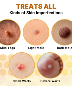 Dermvene™ Organic Skin Tag Solution