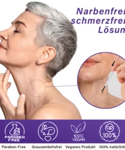 Dobshow™ AraneaCare Skin Blemish Remover