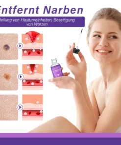 Dobshow™ AraneaCare Skin Blemish Remover