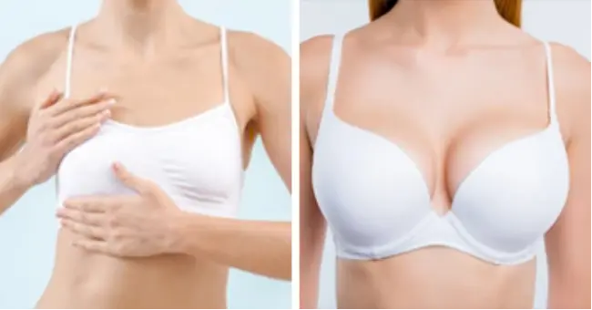 Dobshow™ Breast Enhancement Cream