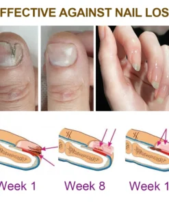 Dobshow™ Fungus-Free Bee Venom Nail Treatment Serum