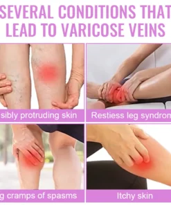 Dobshow™ Varicose Veins Cream