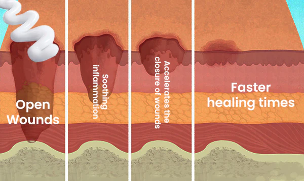 Einze™ Diabetic Wounds Treatment Cream