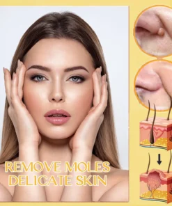 FLYCARE™ Bee Venom Tags & Moles Remover