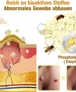 FLYCARE™ Bee Venom Tags & Moles Remover