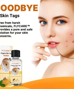 FLYCARE™ Organic Skin Tag Solution