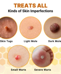 FLYCARE™ Organic Skin Tag Solution