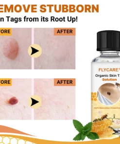 FLYCARE™ Organic Skin Tag Solution