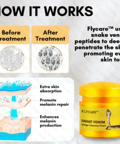 FLYCARE™ Snake Venom Vitiligo Treatment Cream