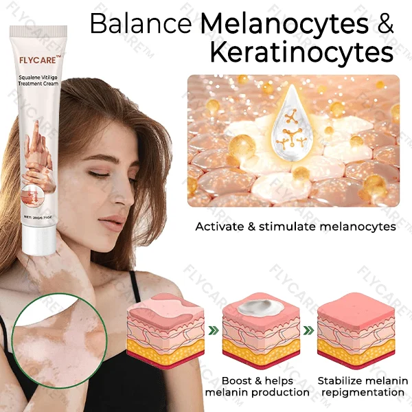 FLYCARE™ Squalene Vitiligo Treatment Cream