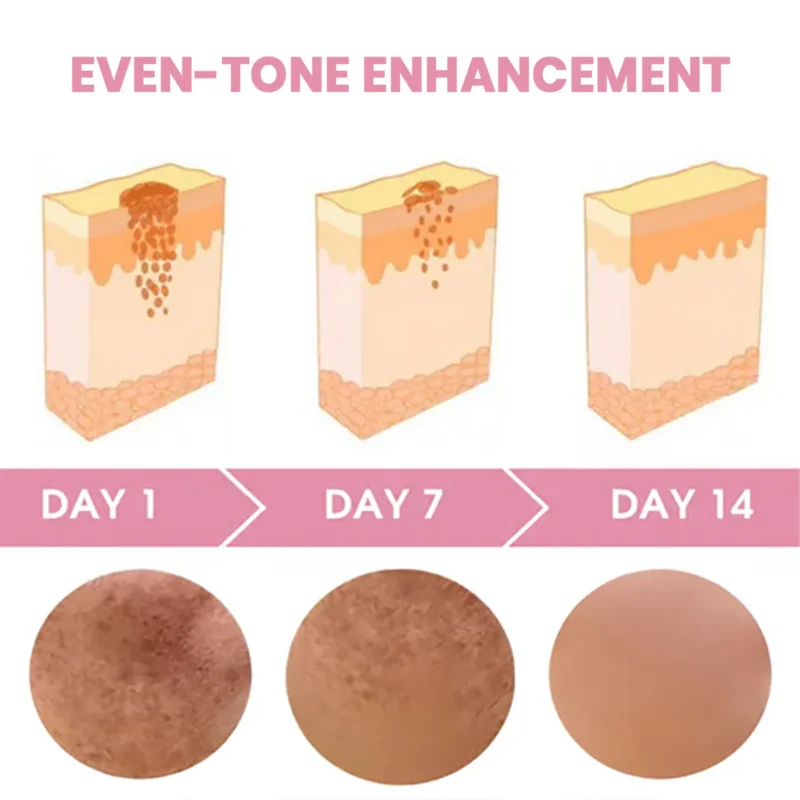 FLYCARE™Dark Spot Remover Whitening Soap