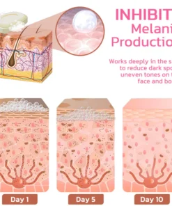 FLYCARE™Dark Spot Remover Whitening Soap