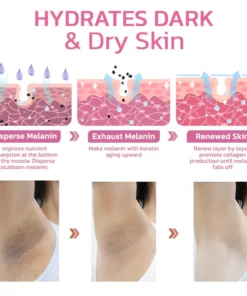 FLYCARE™Dark Spot Remover Whitening Soap