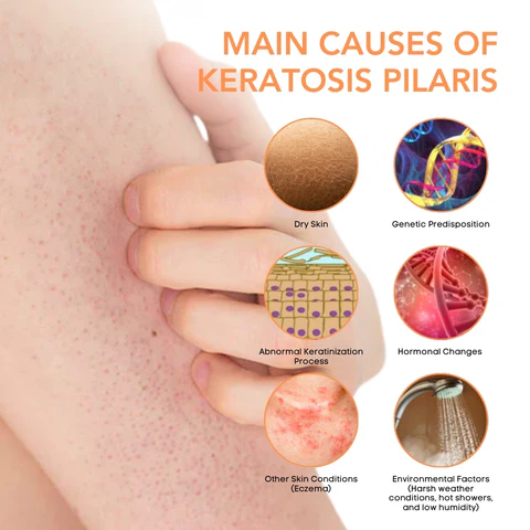 Fivfivgo™ KeraTone Bienengift Seife