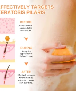 Fivfivgo™ KeraTone Bienengift Seife