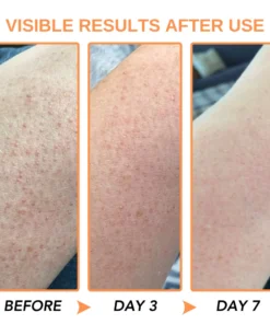 Fivfivgo™ KeraTone Bienengift Seife