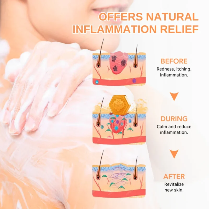 Fivfivgo™ KeraTone Bienengift Seife