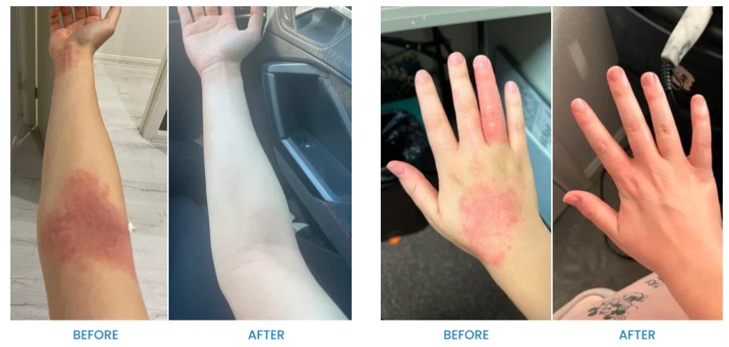 Fivfivgo™ Natürliche Beruhigende Creme für Ekzeme aus dem Ozean