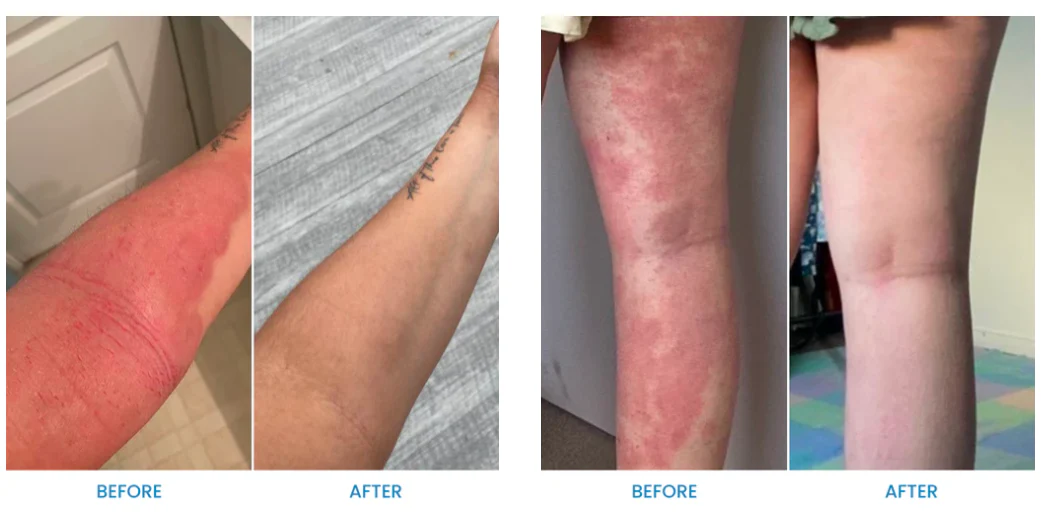 Fivfivgo™ Natürliche Beruhigende Creme für Ekzeme aus dem Ozean