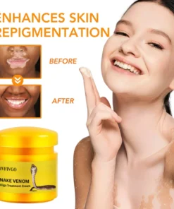 Fivfivgo™ Schlangengift Vitiligo Behandlung Creme