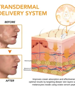 Fivfivgo™ Schlangengift Vitiligo Behandlung Creme