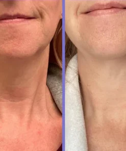 Fivfivgo™ Straffungs- & Lift-Creme für den Hals