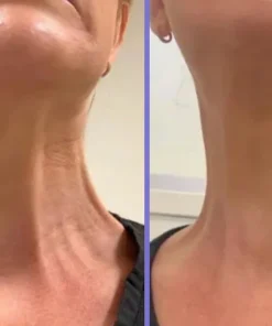 Fivfivgo™ Straffungs- & Lift-Creme für den Hals