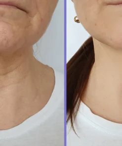 Fivfivgo™ Straffungs- & Lift-Creme für den Hals