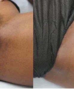 Flycare™ PureGlow Retinol Skin Whitening Cream