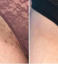 Flycare™ PureGlow Retinol Skin Whitening Cream