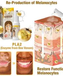 Flycare™ VitiGO Bee Venom Therapy Spray