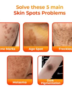 Flysmus™ KojiWhite Kojic Acid Dark Spot Corrector Soap