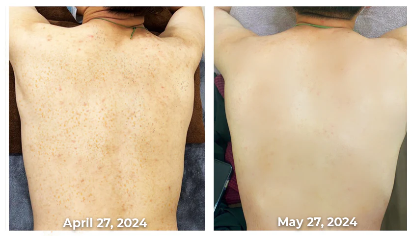 Flysmus™ KojiWhite Kojic Acid Dark Spot Corrector Soap