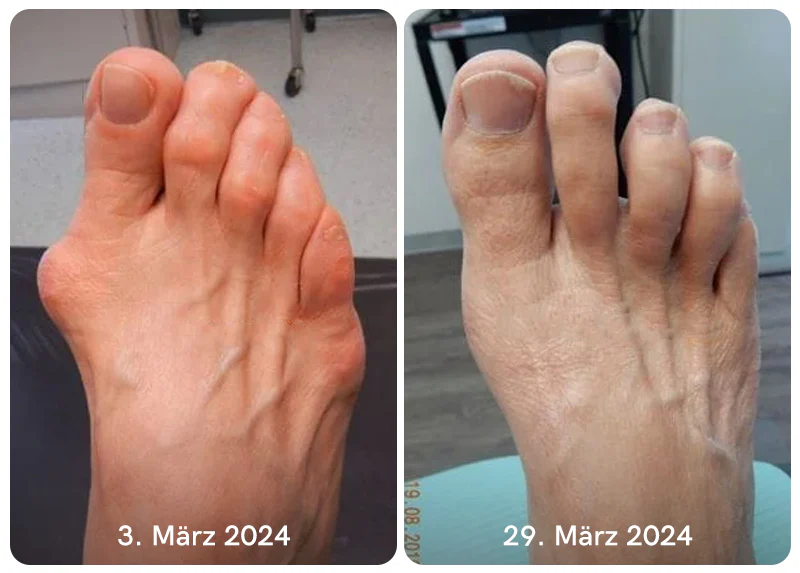 Furzero™ Bienengift Bone & Joint Professional Care Gel