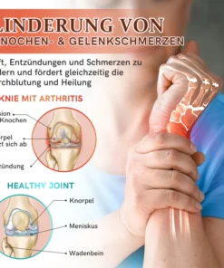 Furzero™ Bienengift Bone & Joint Professional Care Gel