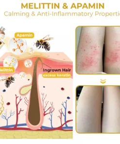 Furzero™ Cleartosis Bee Venom Keratosis Pilaris Spray