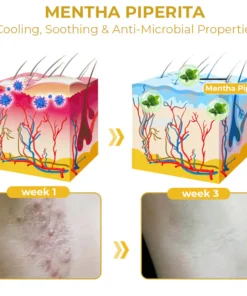 Furzero™ Cleartosis Bee Venom Keratosis Pilaris Spray